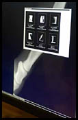 Keeneland Hosts Digital X-Ray Technology Demonstration Keeneland Hosts Digital X-Ray Technology Demonstration